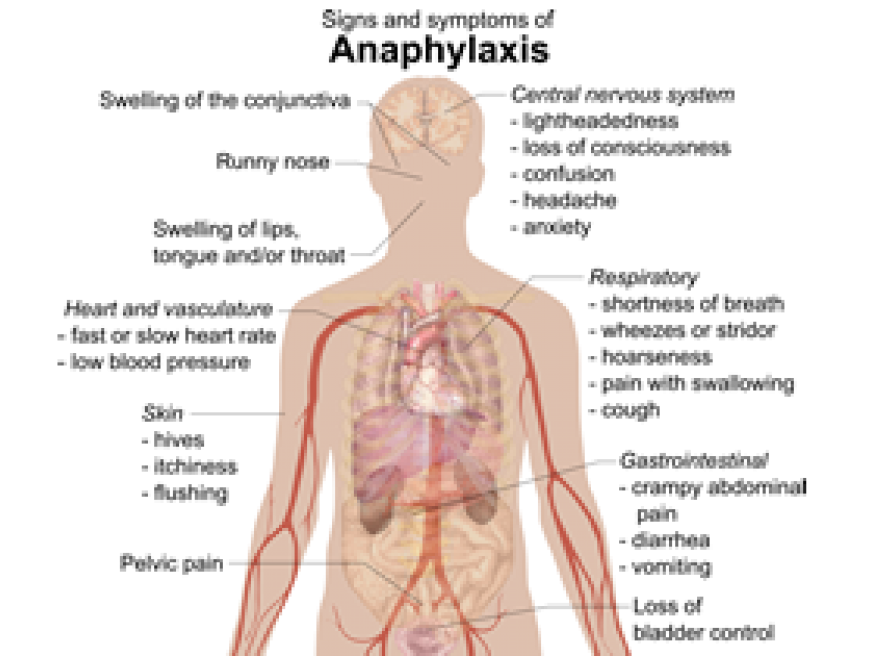 Anaphylaxis